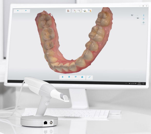 San Jose 3D Cone Beam and 3D Dental Scans