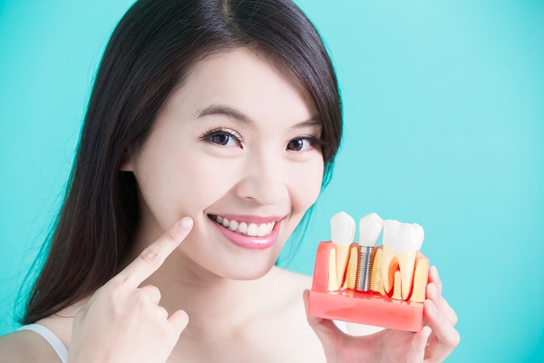 Questions To Ask Your Dentist About Dental Crown