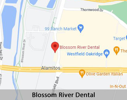 Map image for Implant Supported Dentures in San Jose, CA